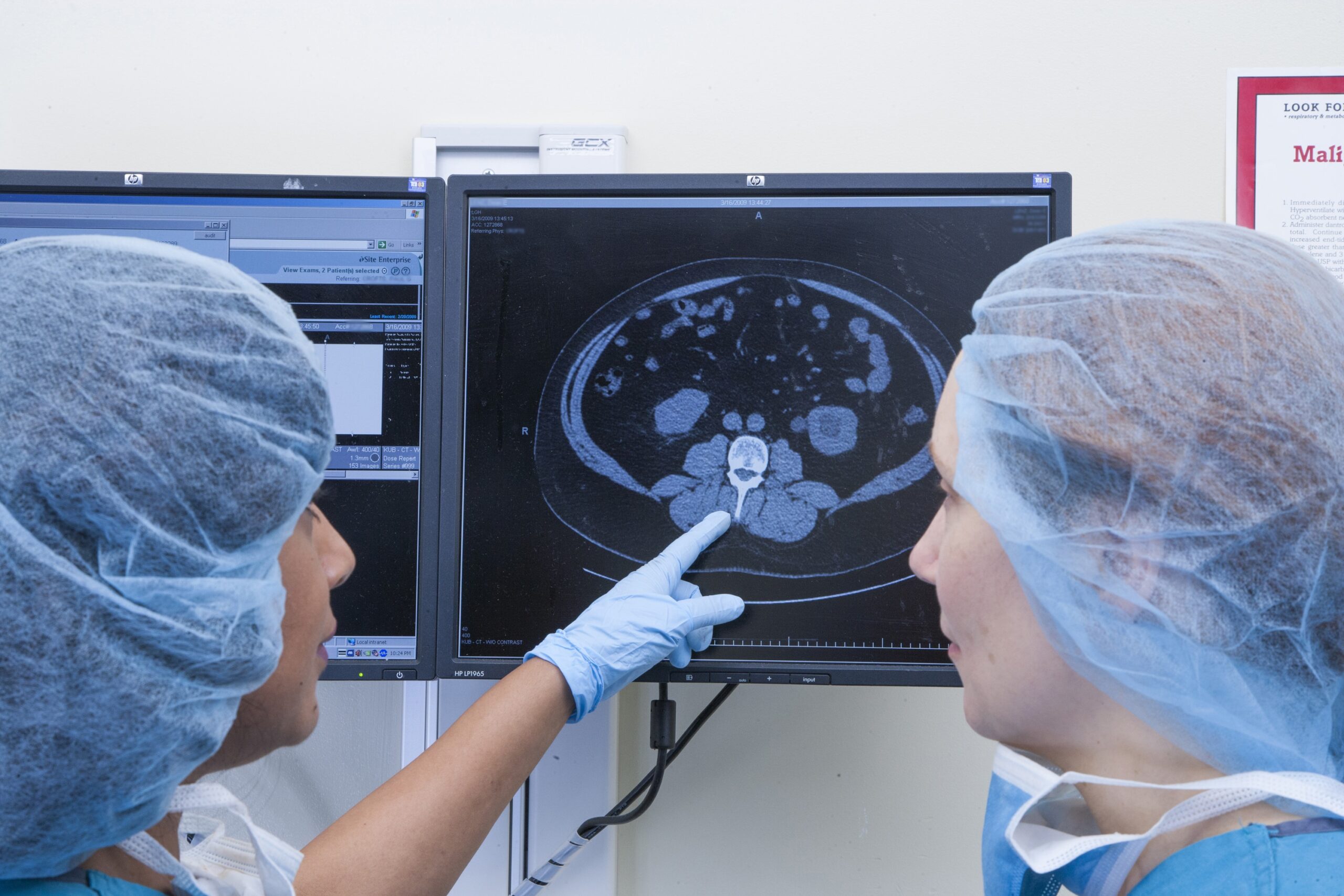 Doctors looking at brain tumor x-ray